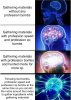 Expanding-Brain.jpg